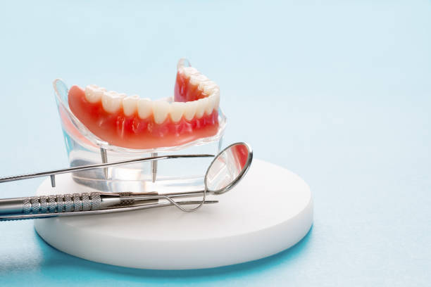 Best Teeth Whitening  in Bunk Foss, WA